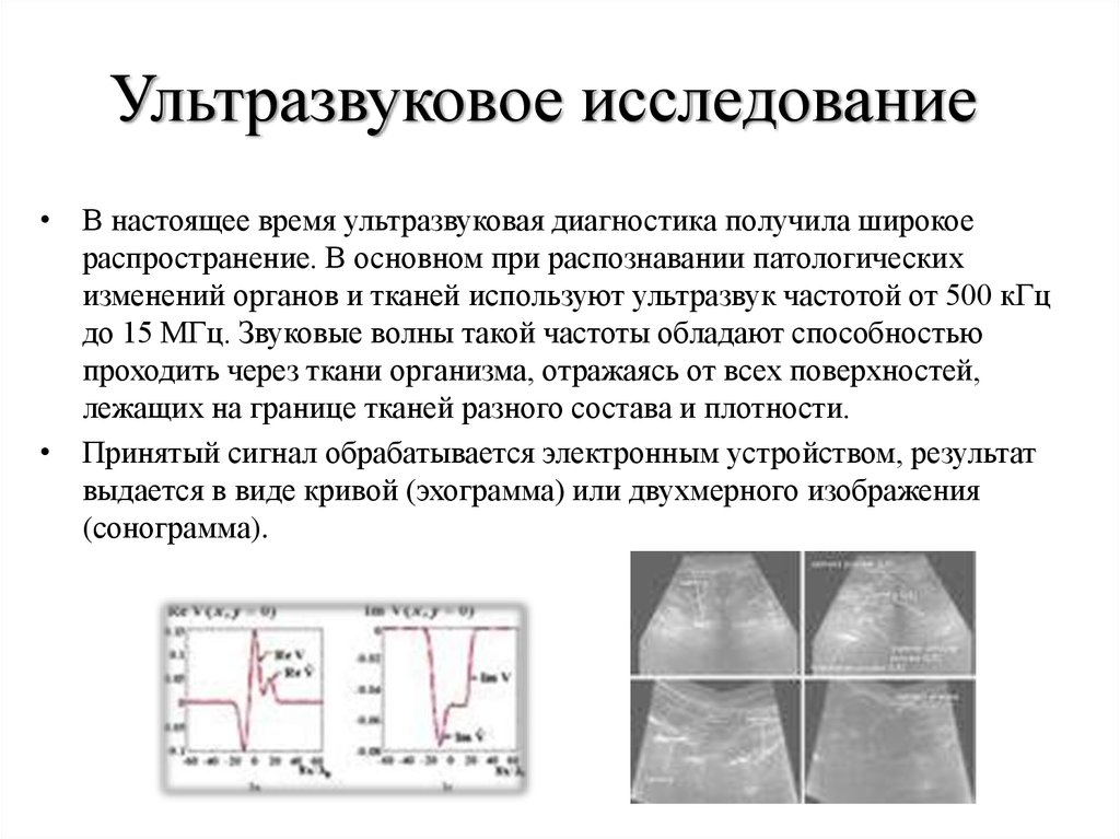 Карта ультразвукового исследования