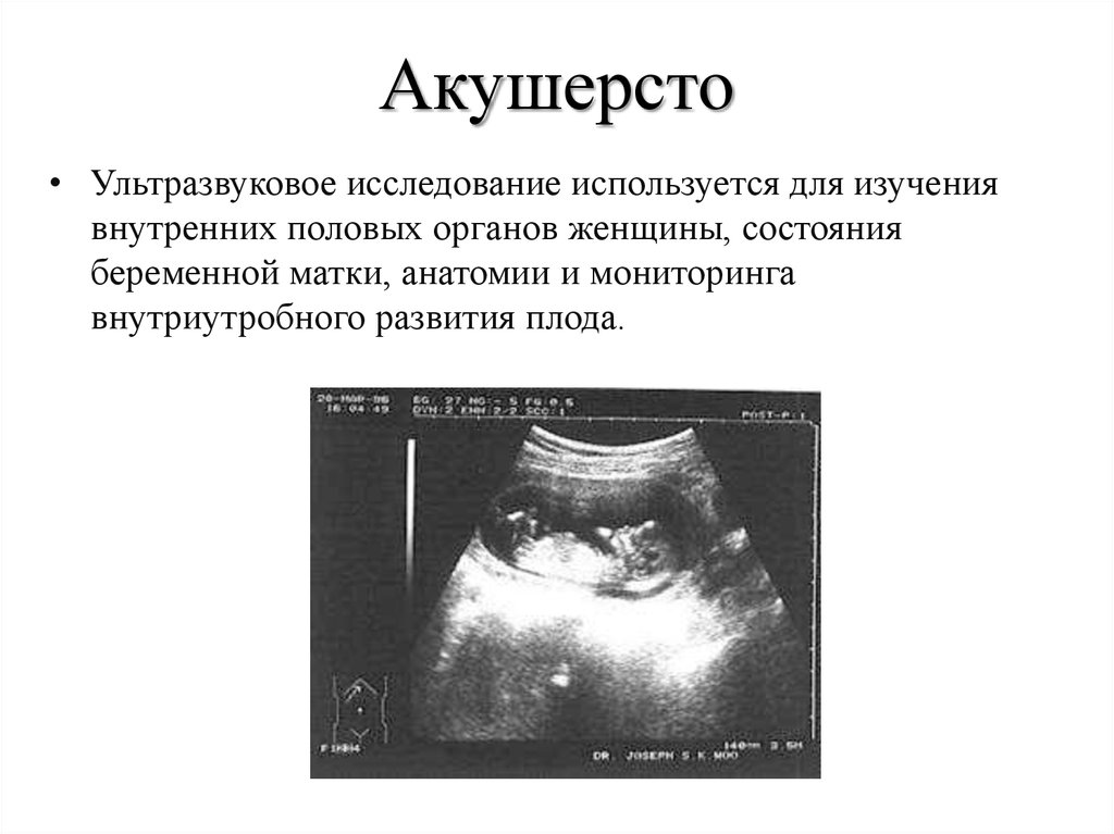 Изменение матки при беременности. УЗИ исследование. Ультразвуковая анатомия матки. Внутреннее УЗИ. Брюшная беременность УЗИ.