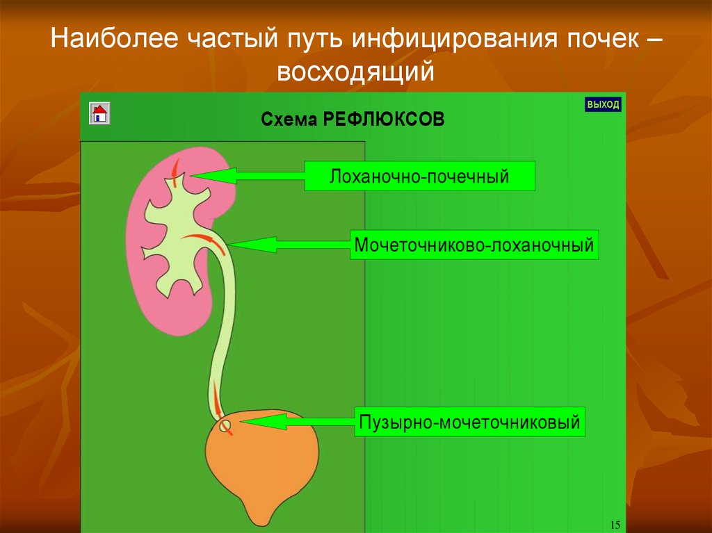 Частый путь. Наиболее частый путь инфицирования почек. Пути проникновения инфекции в почку. Восходящий путь инфицирования почек. Пути проникновения инфекции при пиелонефрите.