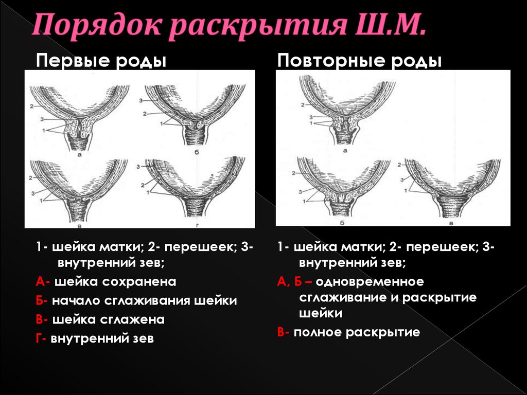 Первые в роду 2. Раскрытие шейки матки при родах в картинках. Раскрытие шейки матки в родах.