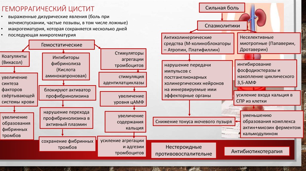 Причины появления цистита