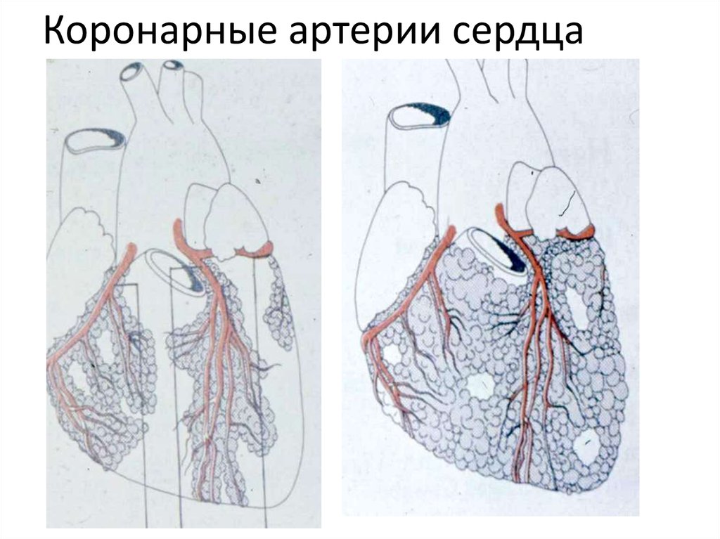 Коронарные артерии сердца фото