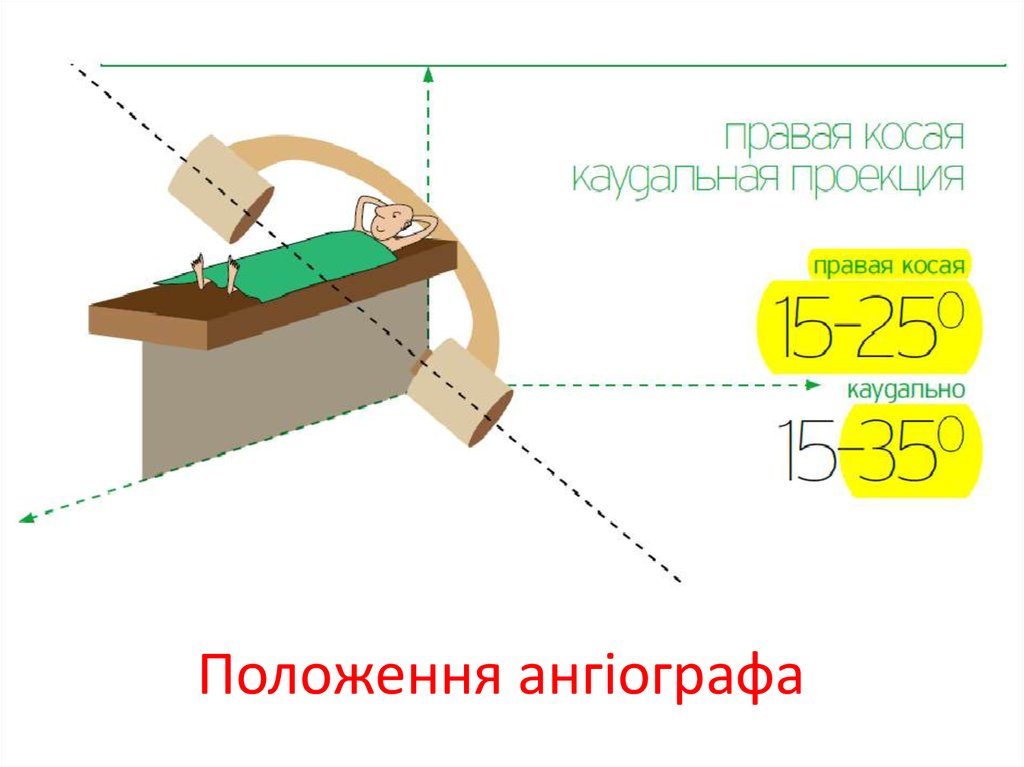 Положення ангіографа