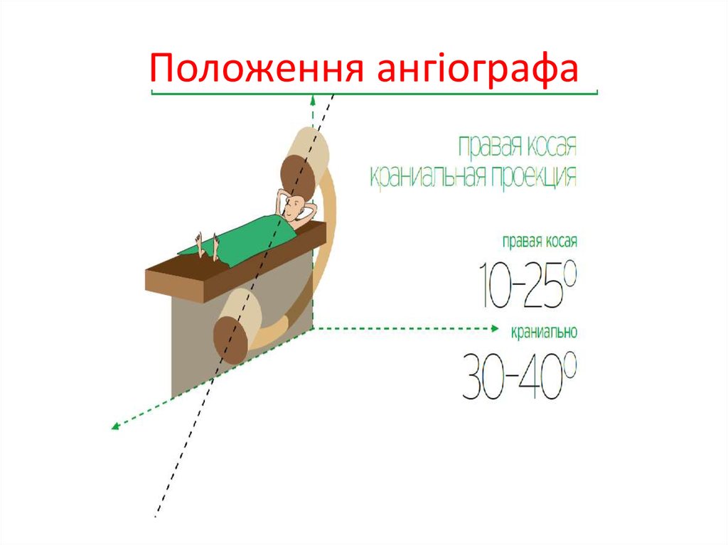 Положення ангіографа