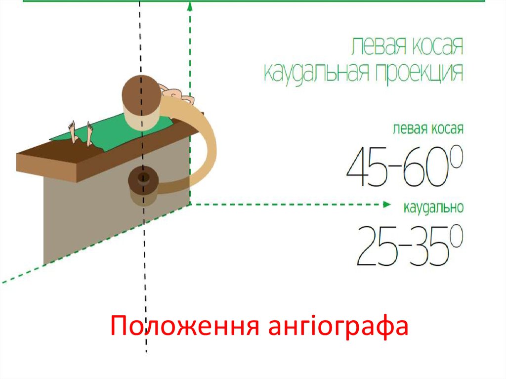 Положення ангіографа