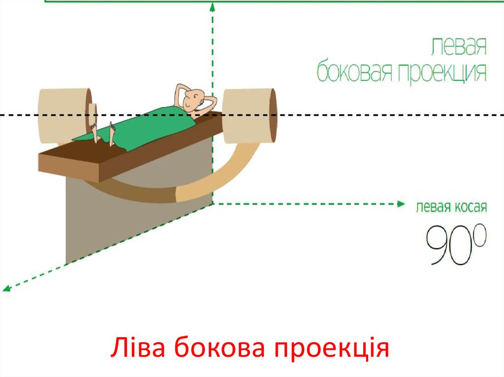 Ліва бокова проекція