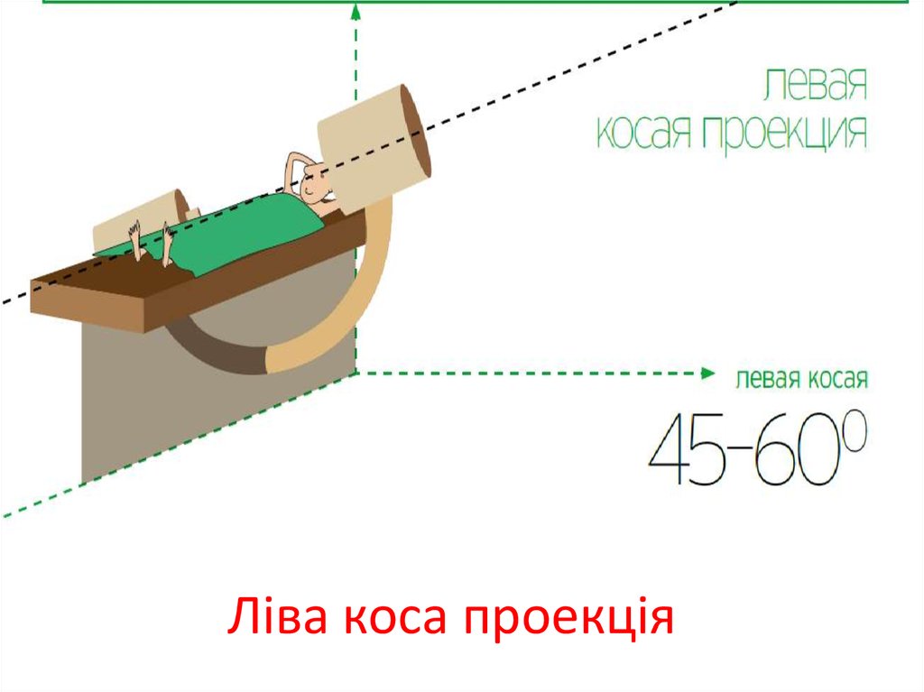 Ліва коса проекція