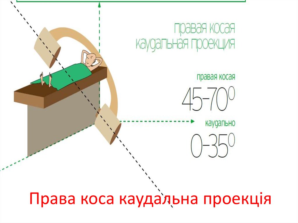 Права коса каудальна проекція