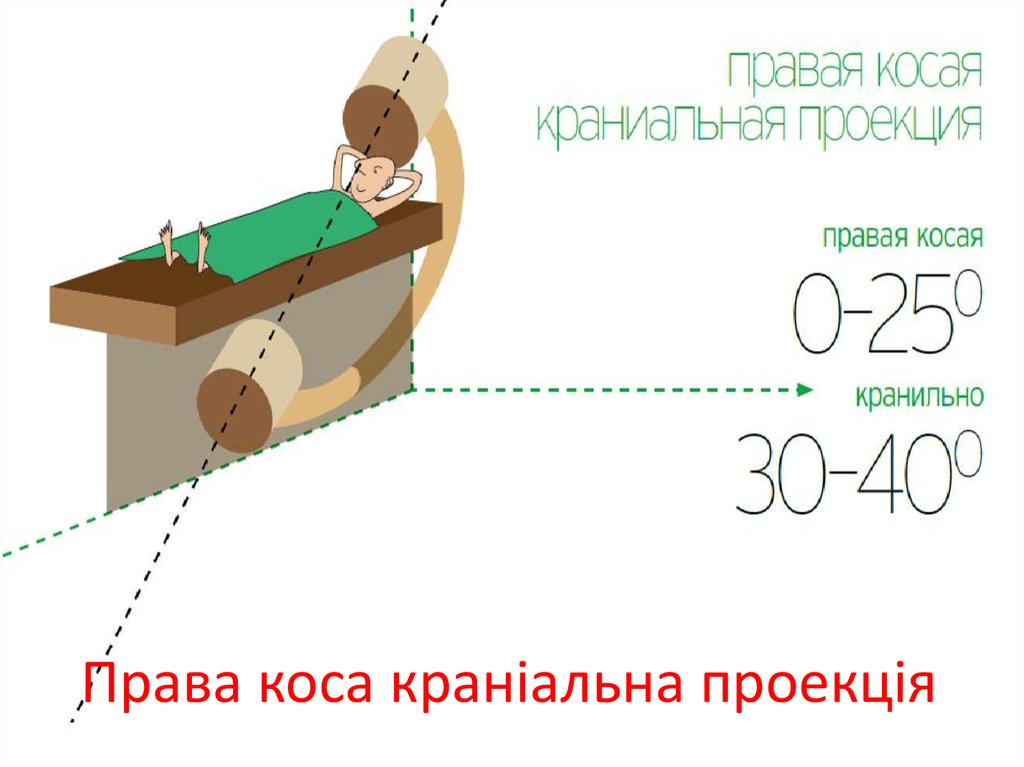 Права коса краніальна проекція