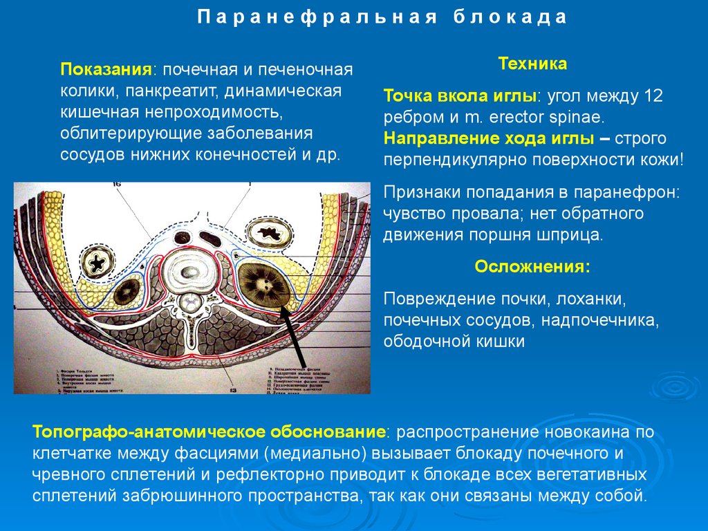 Топографическая анатомия пространства. Сосуды поясничной области топографическая анатомия. Послойная топография поясничной области. Топография поясничной области и забрюшинного пространства. Забрюшинное клетчаточное пространство.