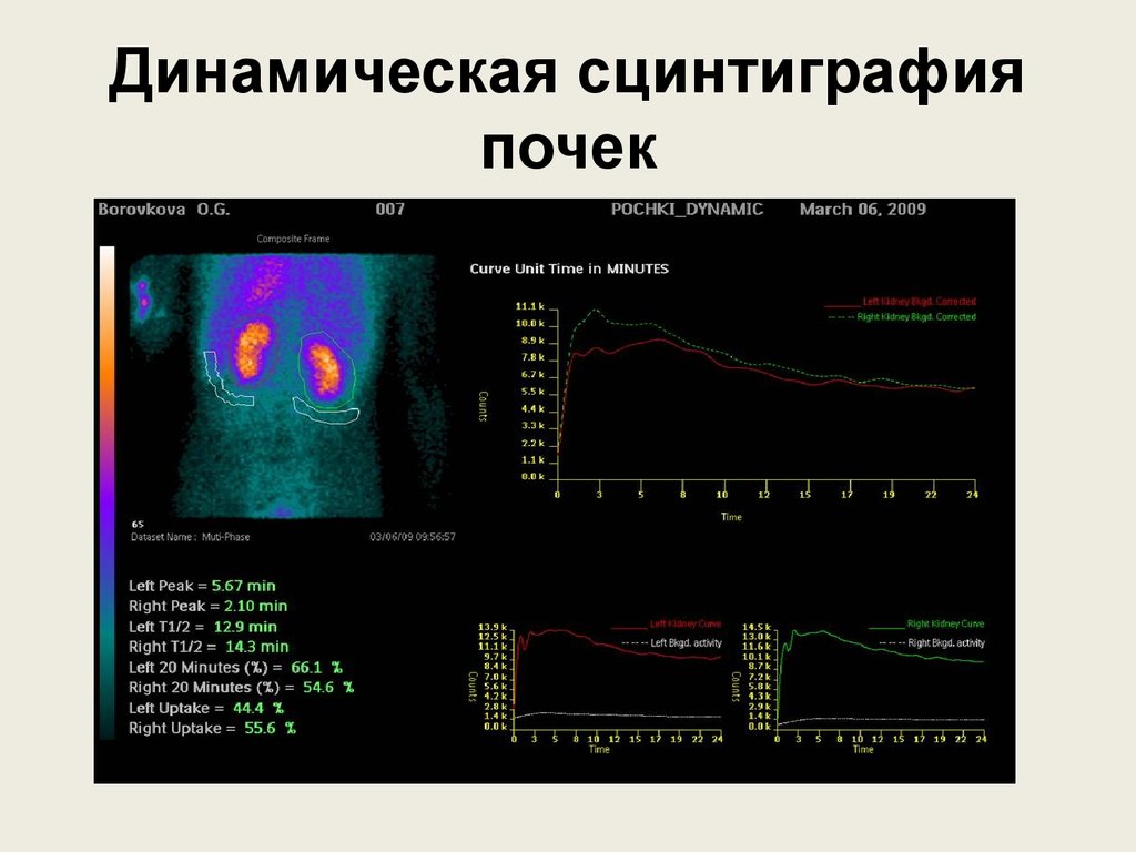 Радионуклидная диагностика фото