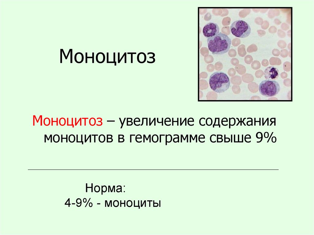 Моноциты в крови норма у мужчин. Лейкоцитоз моноцитоз. Моноцитоз гранулопения. Моноцитоз и нейтропения. Относительный моноцитоз.