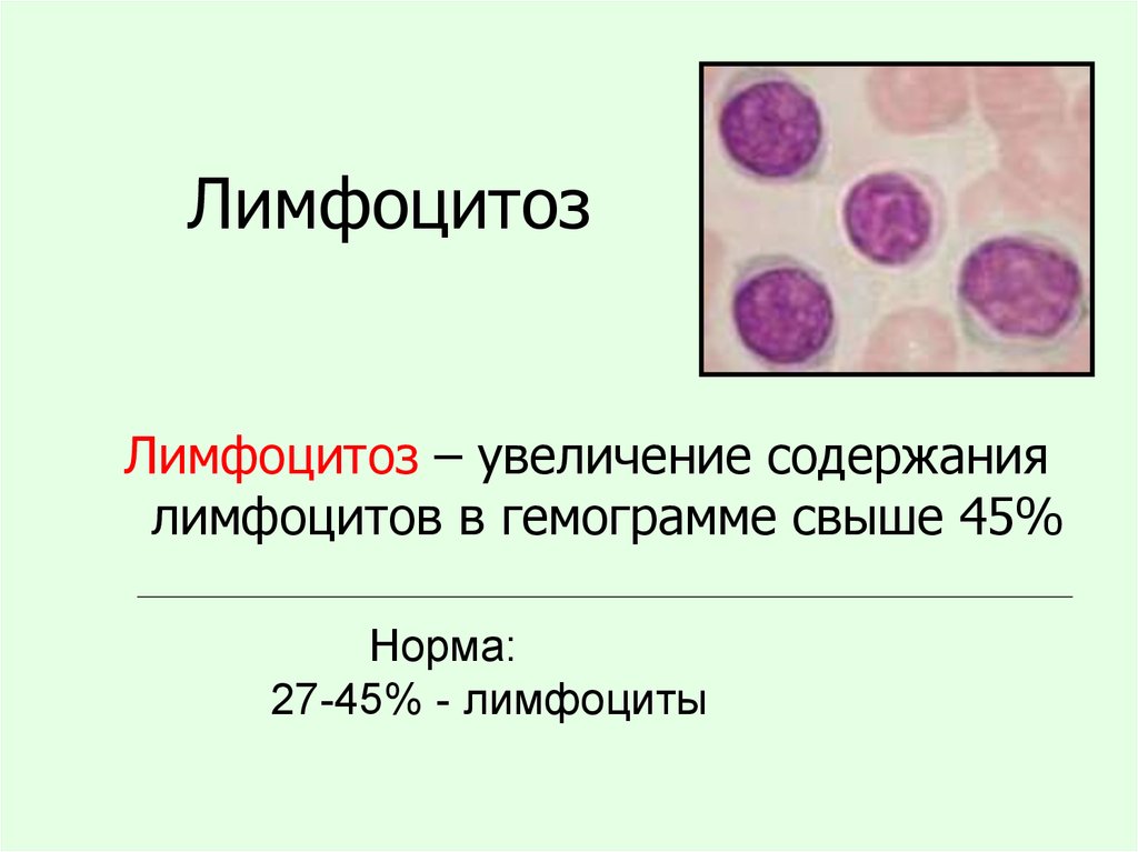 Лимфоциты снизились