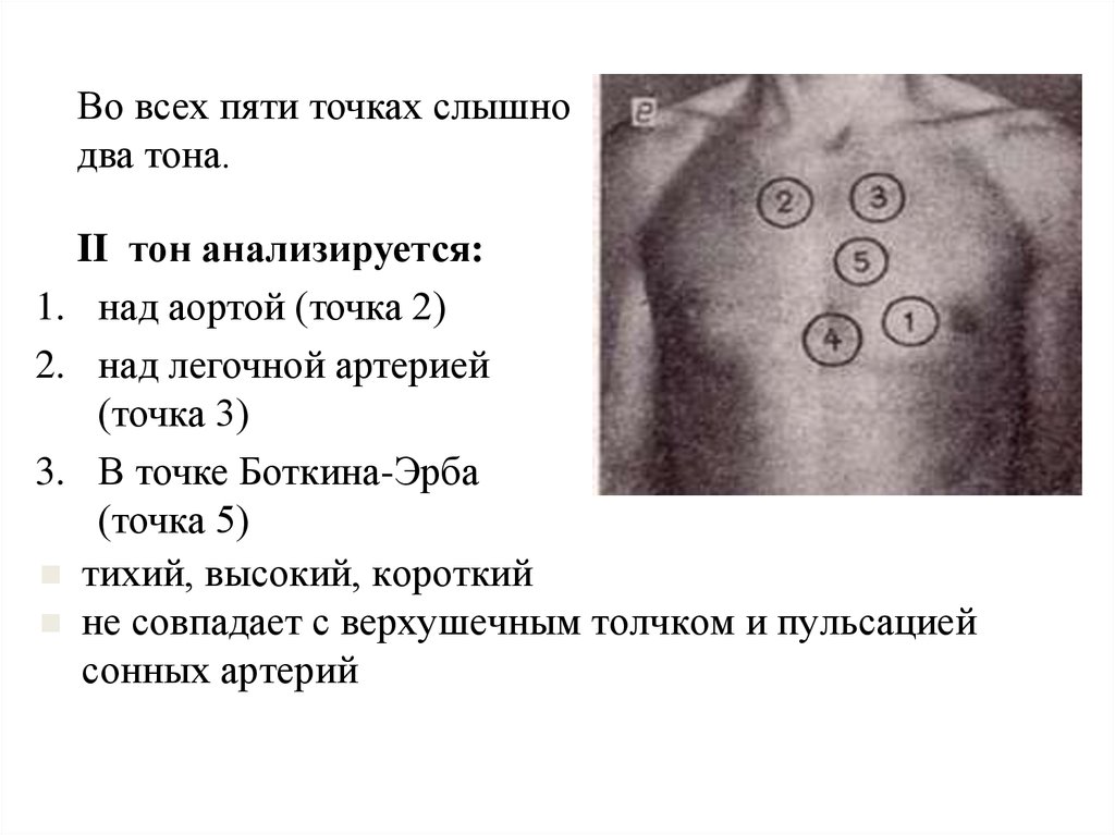 Аускультация сердца пропедевтика презентация