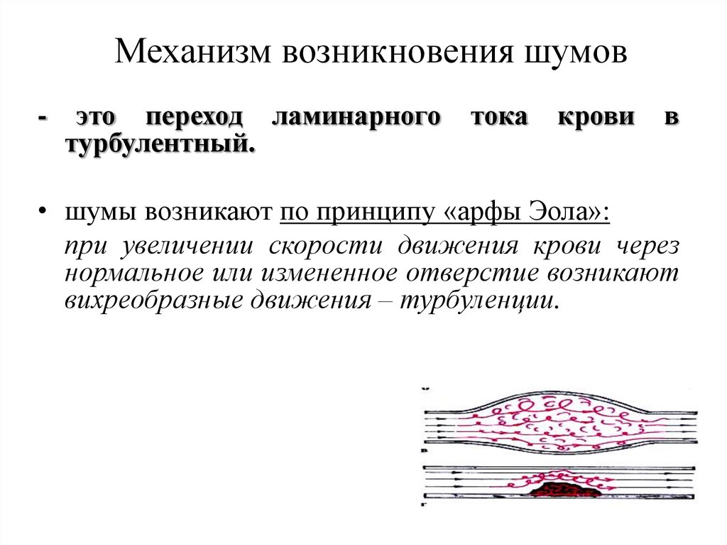 Шумы сердца пропедевтика презентация