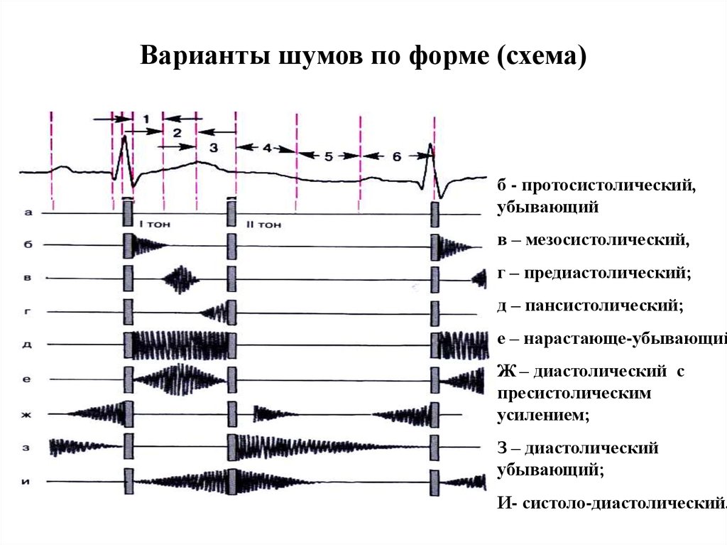 Схема тоны сердца