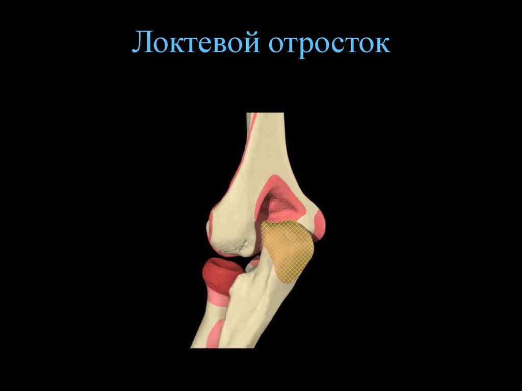 Венечный отросток локтевой кости фото