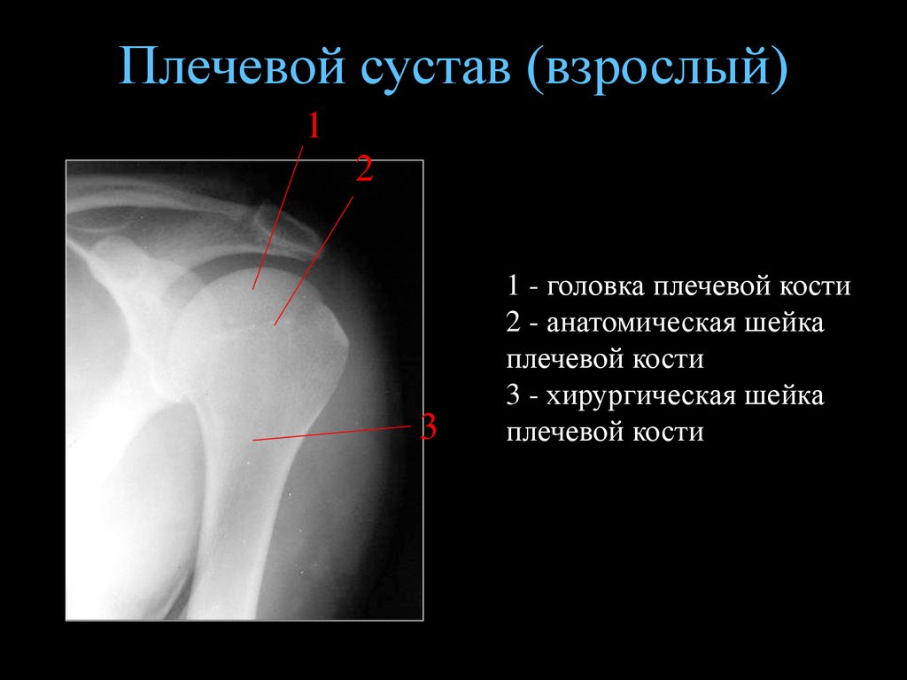 Фото правого плечевого сустава снимок здорового