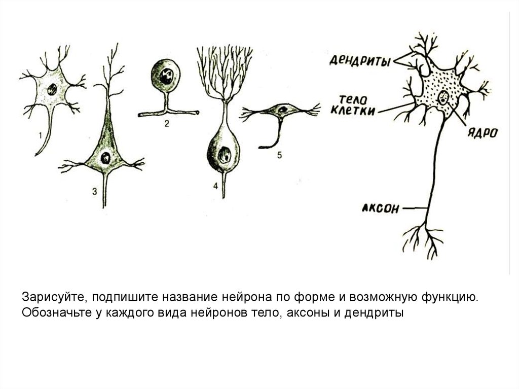 Назовите нейрон. Классификация нейронов по форме. Классификация нейронов по форме клетки. Типы нейронов по форме тела. Нейроны по форме перикариона.