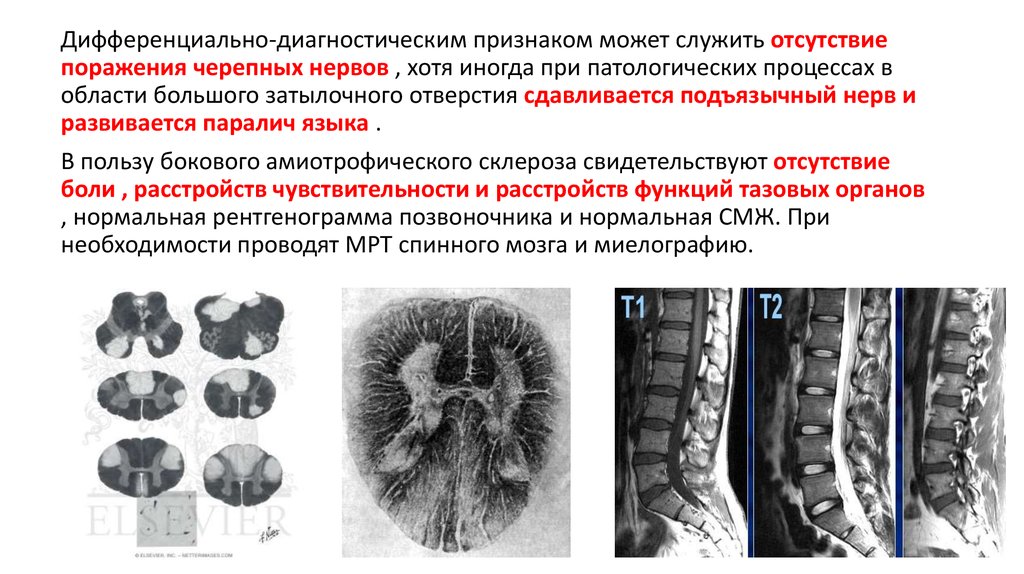 Презентация атрофия и склероз