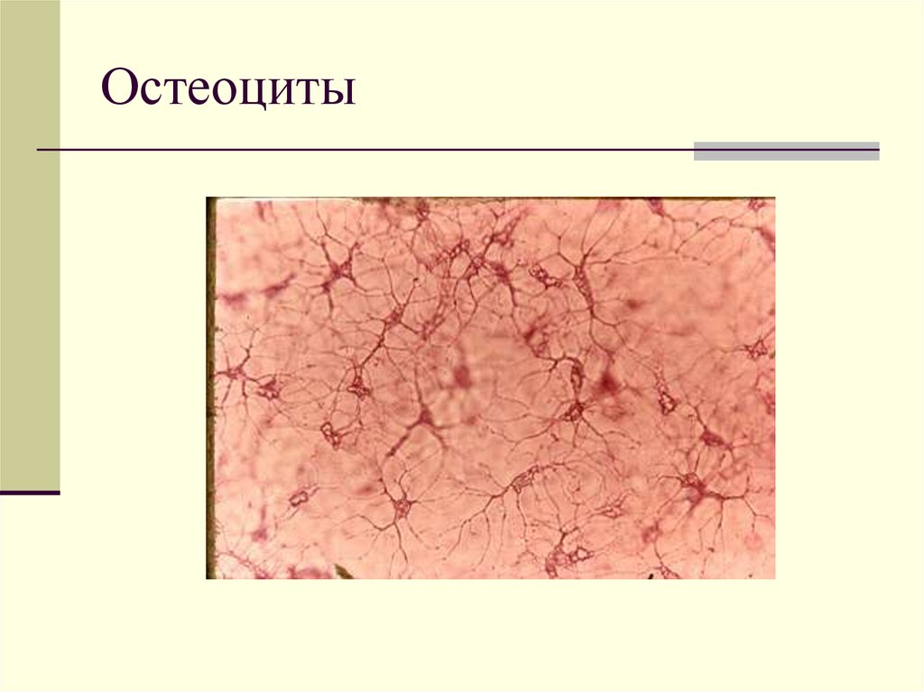 Остеоцит. Остеоциты гистология препарат. Клетки остеоциты. Отростки остеоцитов. Остеоцит ткань.