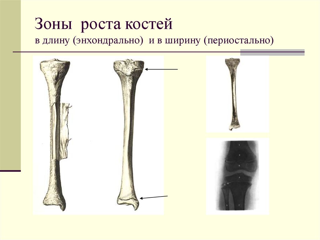 Пластина роста. Зона роста трубчатых костей. Зоны роста трубчатых костей у детей. Зона роста большеберцовой кости. Зона роста бедренной кости.