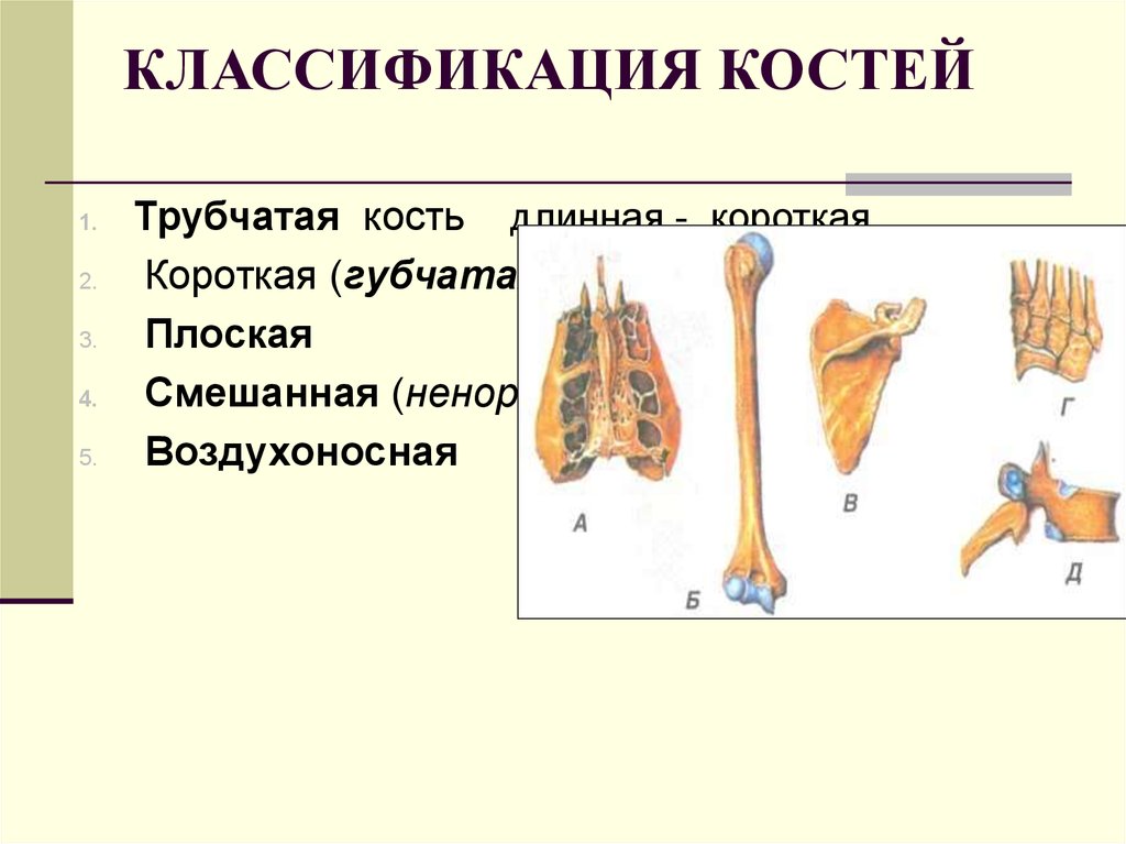 Классификация костей