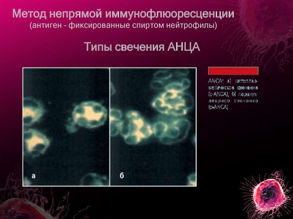 Антинейтрофильные цитоплазматические антитела