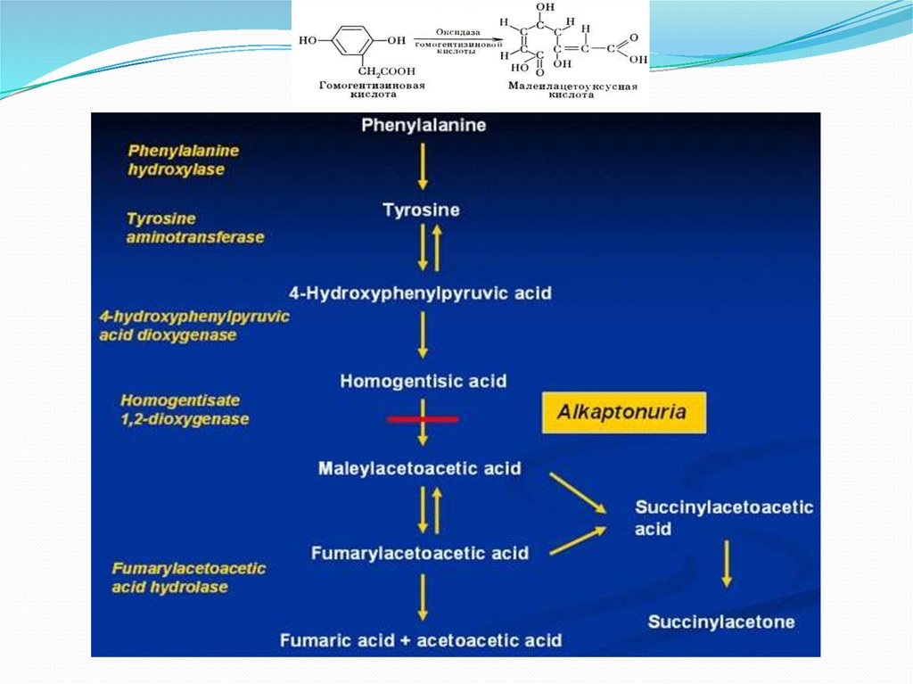 Болезни нарушения аминокислот. Алкаптонурия тирозин. Алкаптонурии биохимия. Алкаптонурия схема. Алкаптонурия причины биохимия.