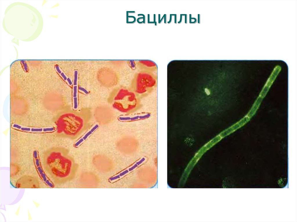 Бацилла это. Бациллы микробиология. Палочковидные бактерии микробиология. Род бациллы микробиология. Бациллы препарат микробиология.