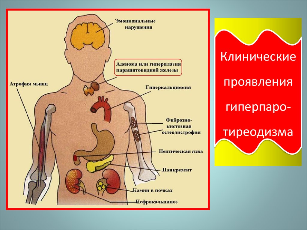 Клиническая железа