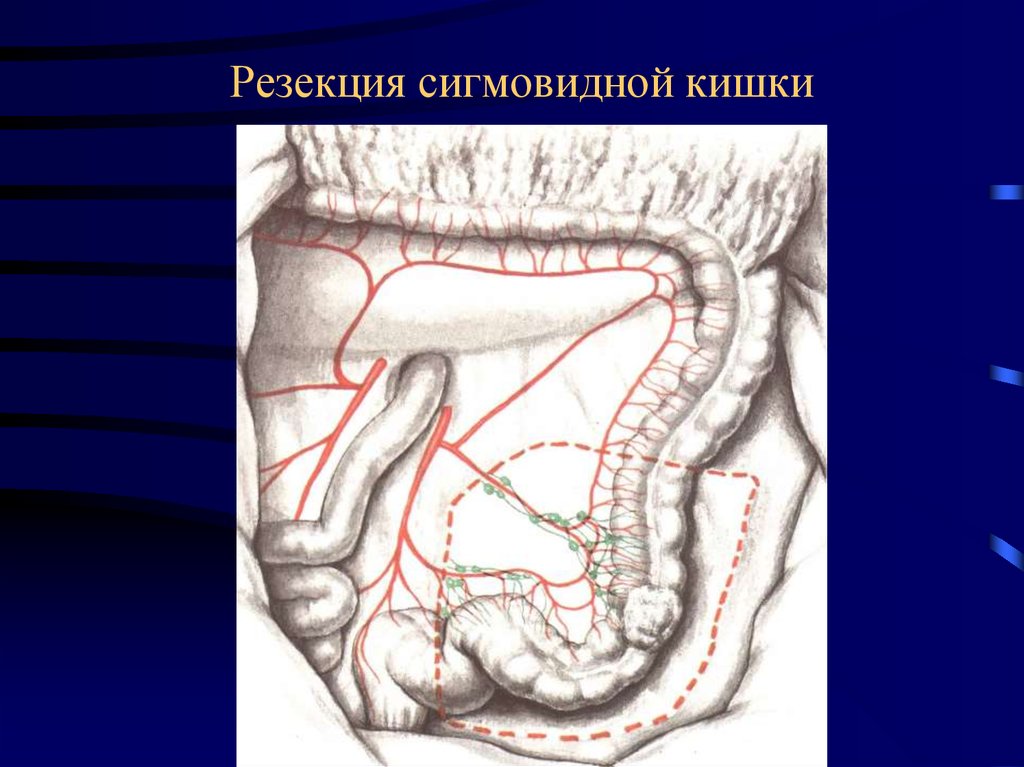 Брыжейка тонкой кишки где находится у человека фото