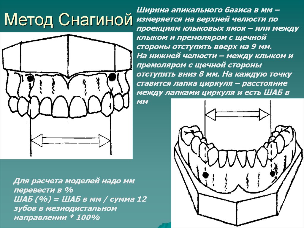 Клыковой ямки. Метод Снагиной. Метод хауса Снагиной. Метод пона метод Снагиной. Измерение апикального базиса челюстей в ортодонтии.