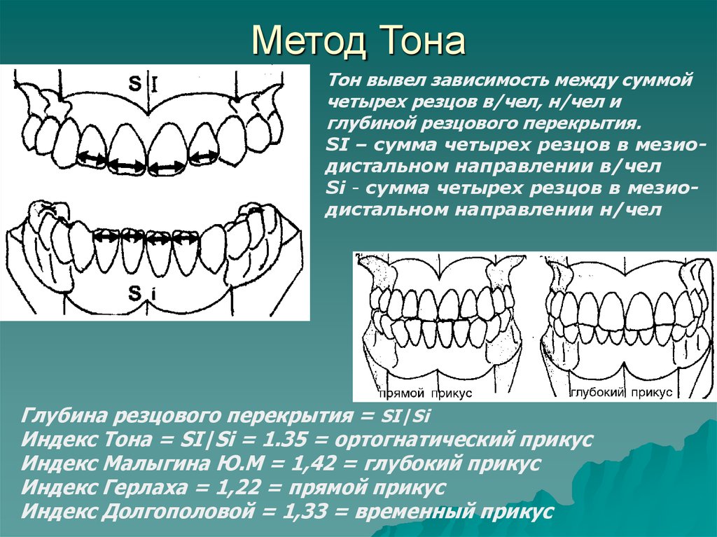 Таблица пона