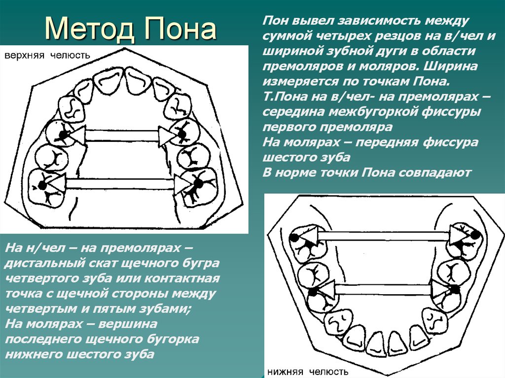 Верхним рядом. Метод Pont ортодонтия. Метод Коркхауза ортодонтия таблица. Метод Герлаха в ортодонтии. Метод Коркхауза в ортодонтии.