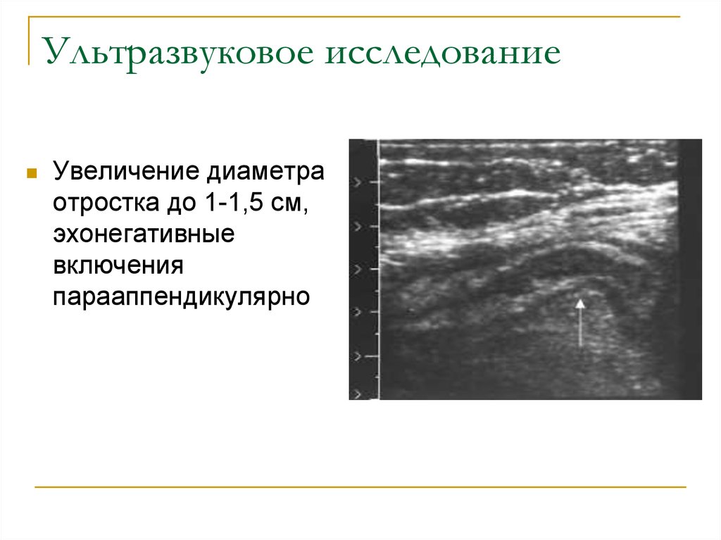 Характеристика эхонегативного изображения