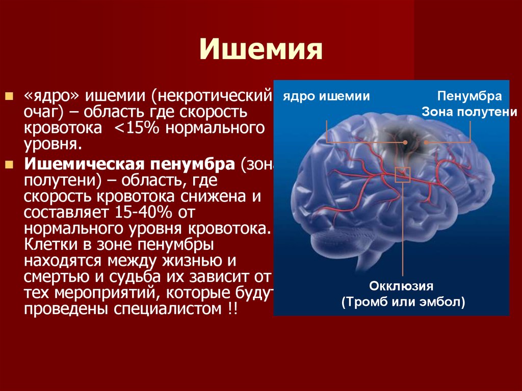 Хроническая ишемия мозга 1. Ишемия мозга. Иш имия головного мозга. Ишемическое поражение мозга. Хроническая ишемическая болезнь головного мозга.