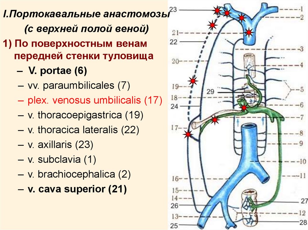 Верхней полой вены. Схема естественных портокавальных анастомозов. Порто-кавальный анастомоз схема. Воротная Вена, Порто-кавальные и кава-кавальные анастомозы.. Схема венозных анастомозов.