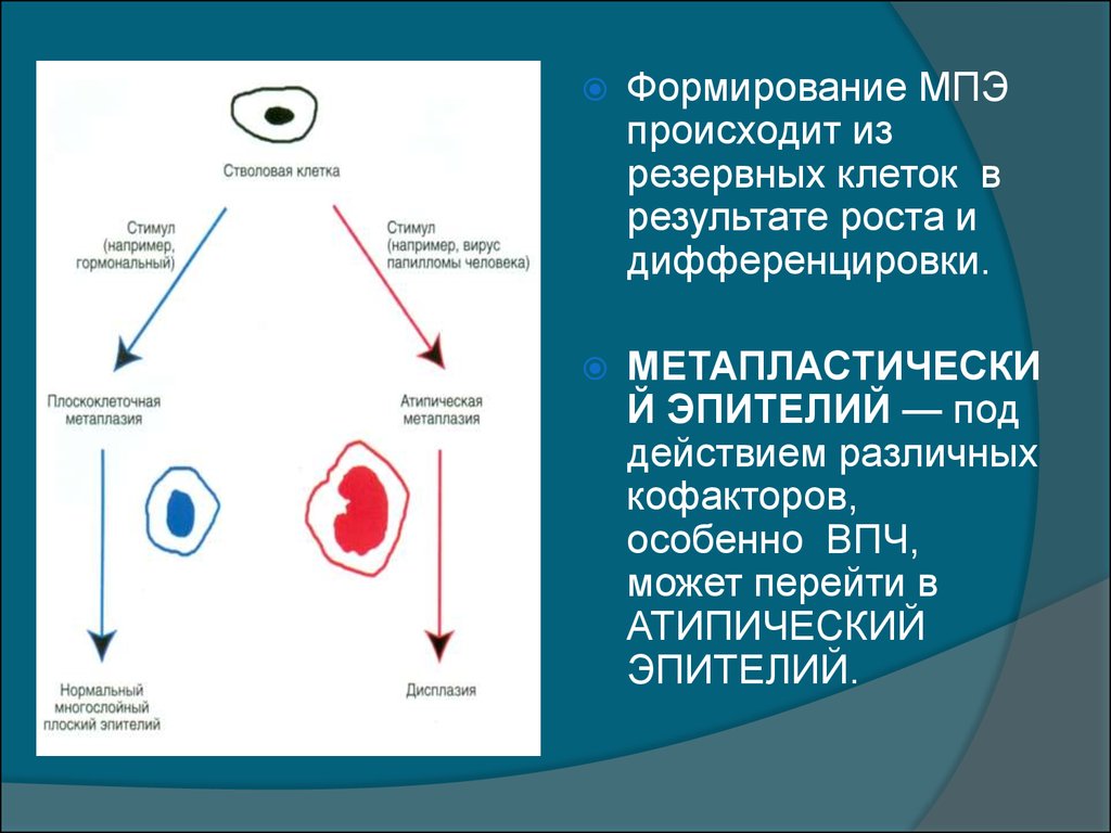 Эктопия с плоскоклеточной метаплазией. Резервные клетки шейки матки. Резервные клетки эпителия шейки матки. Метапластический эпителий. Плоскоклеточная метаплазия шейки матки.