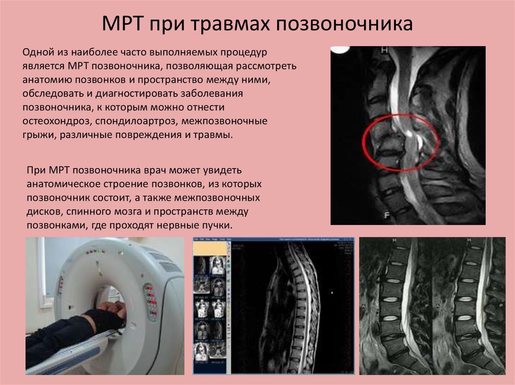 Отделы позвоночника для мрт схема