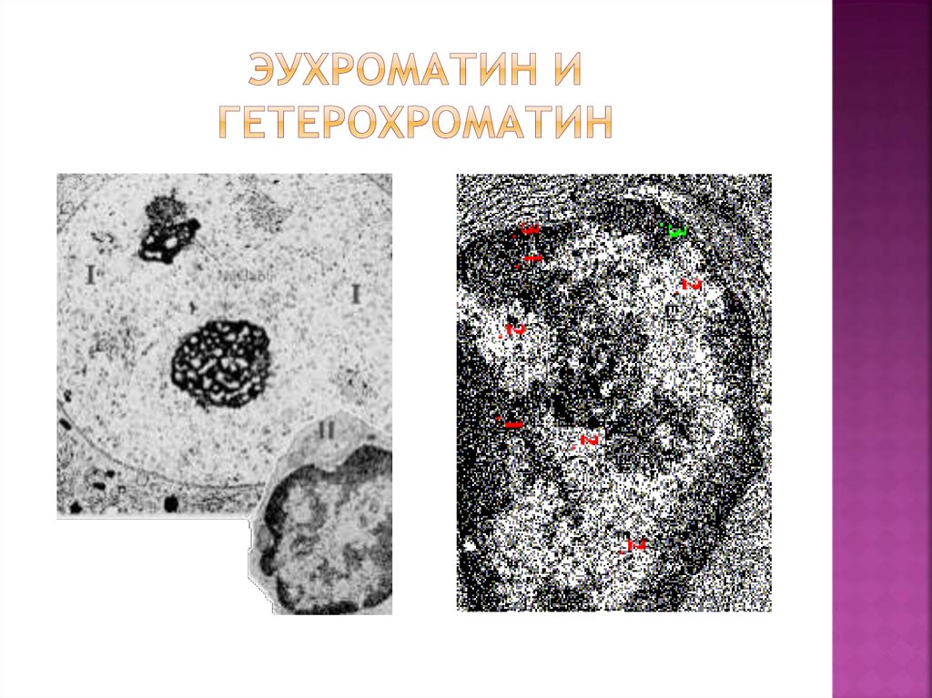 Эухроматин и гетерохроматин это. Строение хромосомы эухроматин. Организация хроматина: эухроматин и гетерохроматин.. Тельце Барра эухроматин.