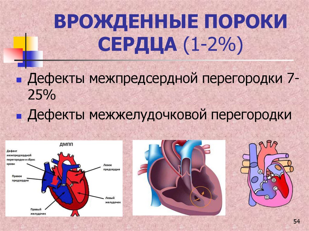 Насколько сердце. Вродденный порог сердца. Врожденный порок сердца (ВПС). При врожденных пороках сердца..