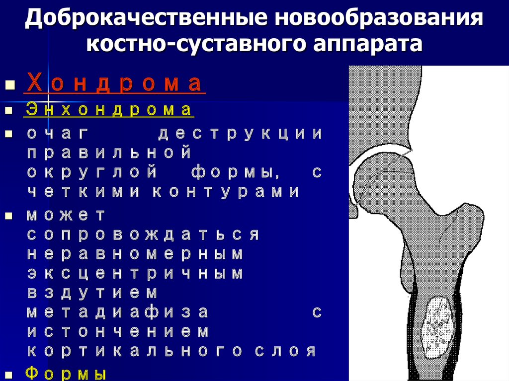 Доброкачественные опухоли блок схема