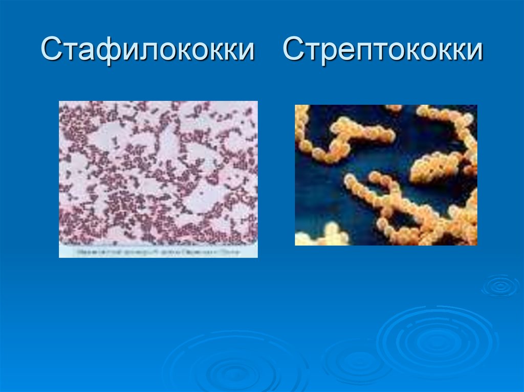 Стафилакока. Бактерии кокки стрептококки. Кокки стафилококки стрептококки. Микрококки диплококки стрептококки сарцины стафилококки. Стафилококки и стрептококки микробиология.