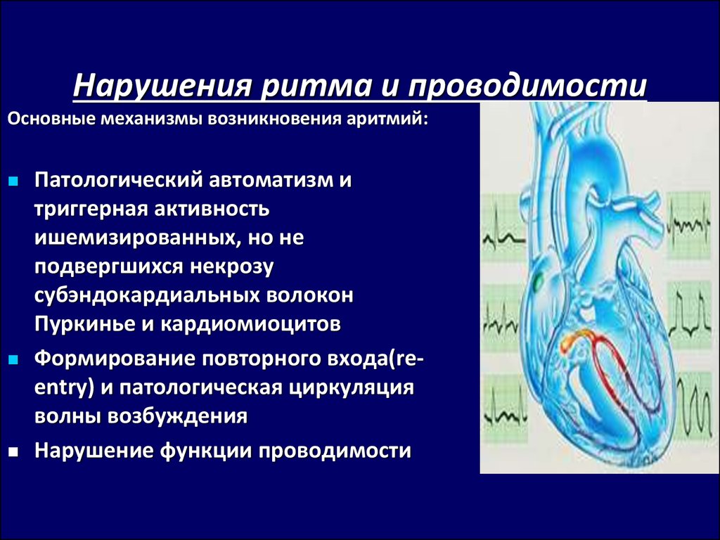 Нарушение проводимости сердца. Нарушение ритма и проводимости. Нарушения сердечного ритма и проводимости. Нарушения сердечной проводимости и ритма (форма).. Нарушение функции проводимости сердца.