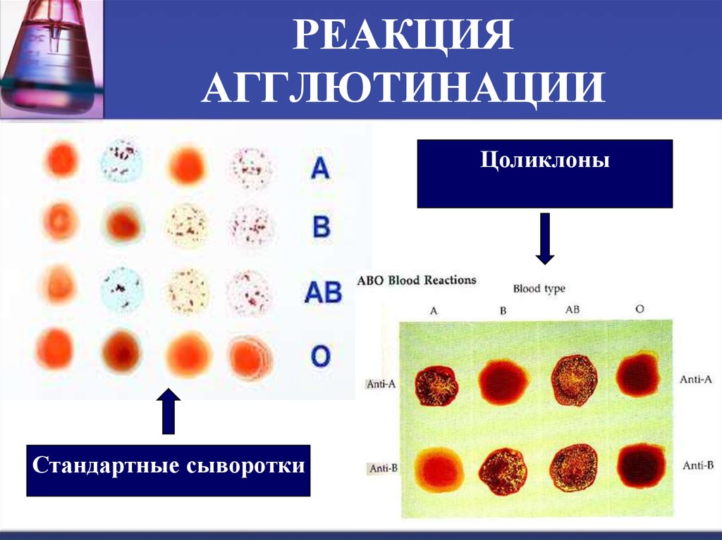 Реакция агглютинации микробиология схема