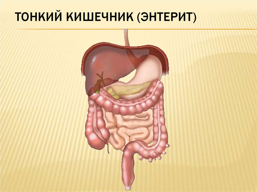 Энтерит. Энтерит тонкого кишечника. Кишечник человека 3 класс.