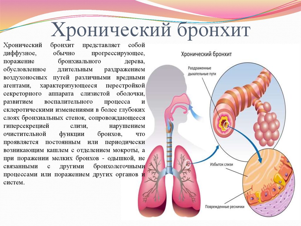 Хронический бронхит презентация