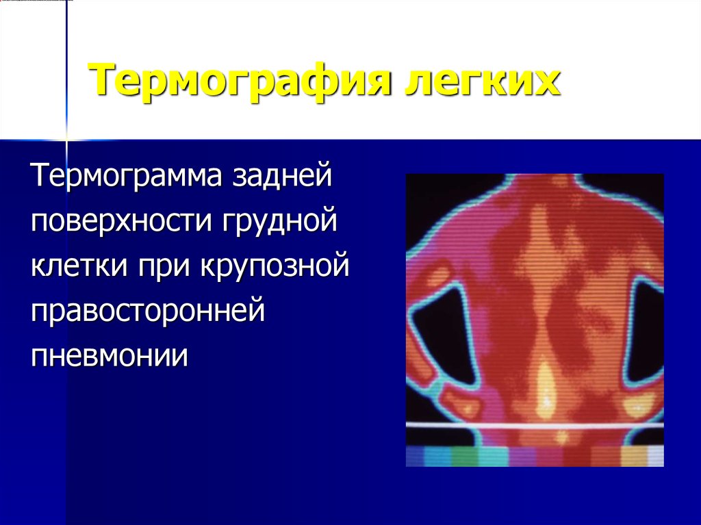 Термография легких