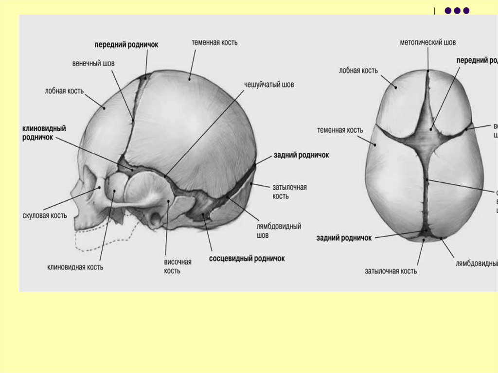 Шов теменных костей. Соединения костей - швы, роднички. Соединение костей черепа роднички. Роднички черепа новорожденного таблица. Роднички передний и боковые задний.